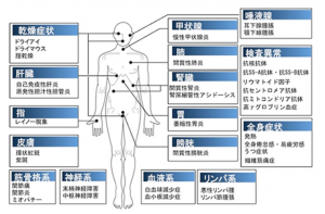 シェーグレン症候群の進行